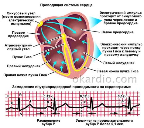 Как распознать нарушение поляризации сердца на ЭКГ