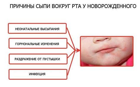 Как смягчить раздражение от слюней у ребенка