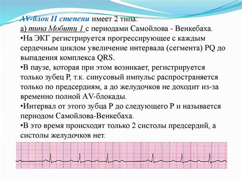 Клинические проявления нарушения межпредсердной проводимости