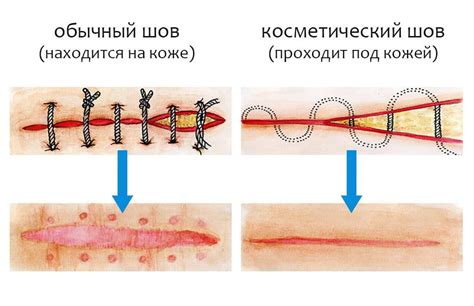 Когда проводить швы