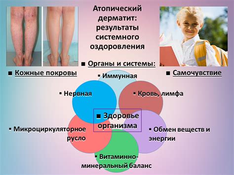 Кожные инфекции и их влияние