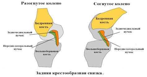 Консервативное лечение хрящевого нароста