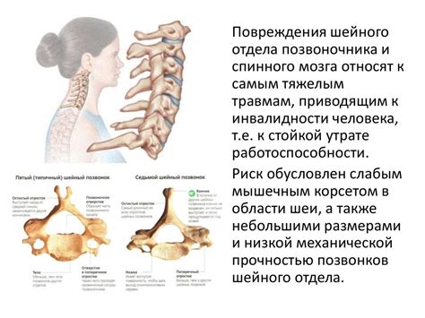 Костные компоненты шейного отдела позвоночника