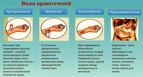 Кровотечение при менструации