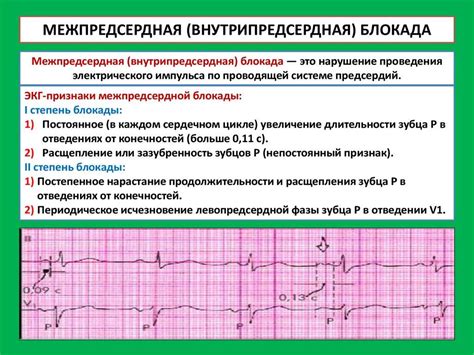 Лечение нарушения атриовентрикулярной проводимости