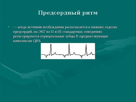 Лечение предсердного ритма на ЭКГ