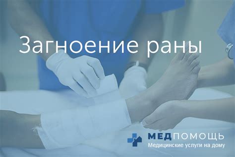 Лечение раны и профилактика инфекции