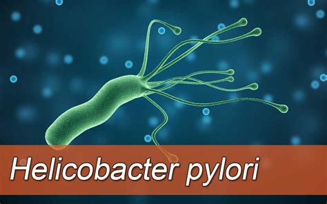 Лечение Helicobacter pylori