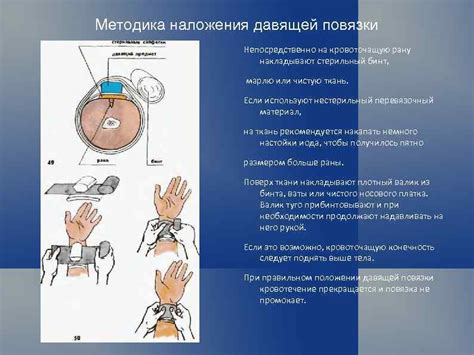 Методика нанесения Траумеля на рану