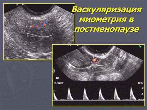 Методы визуализации структур в яичниках