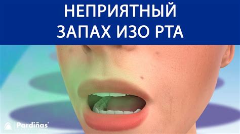 Методы противозапаховой профилактики гуаши изо рта