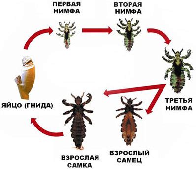 Механическое удаление вшей и яиц