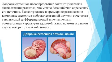 Мокрая гильза и сухая: общие черты и отличия