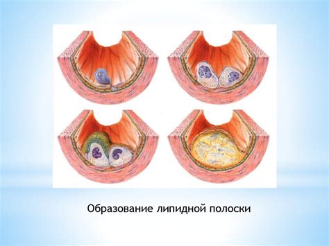 Нарушение липидного обмена