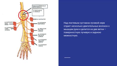 Невропатия медианного нерва