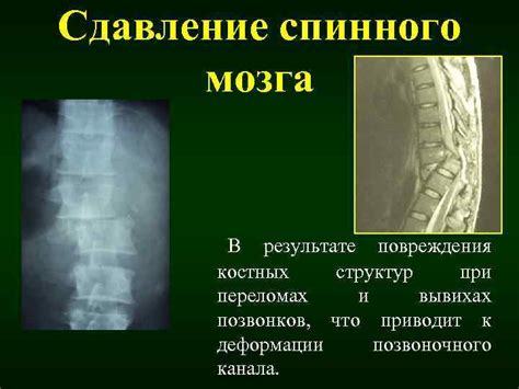 Нервные повреждения и сдавление