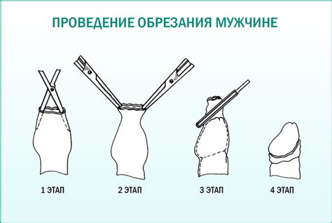 Обрезание мужчин с точки зрения сунны