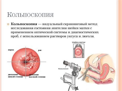 Обычная кольпоскопия: проверенный метод исследования