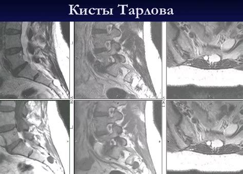 Овариальная киста: особенности проявления и возможные методы лечения