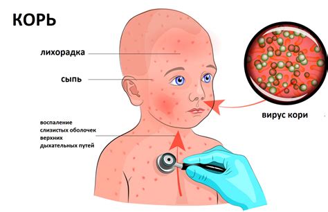 Опасная инфекция: симптомы