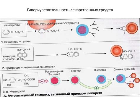 Определение аллергии на пенициллин