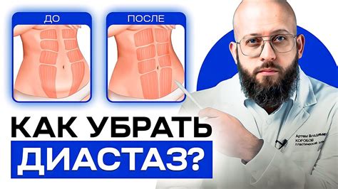 Определение диастаза и его воздействие на организм