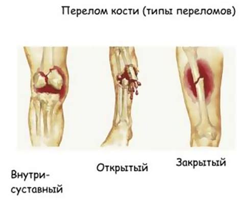 Определите степень травмы: