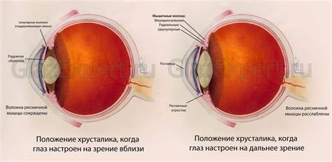 Оптические методы коррекции для пациентов с нарушением аккомодации глаза