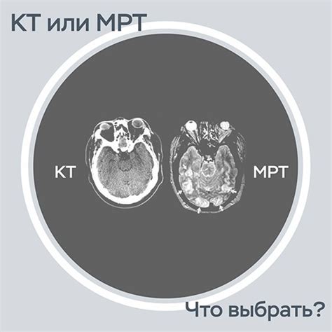 Основное отличие и функционал