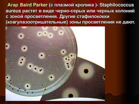 Основные методы выявления наличия бактерии Staphylococcus в полости носа