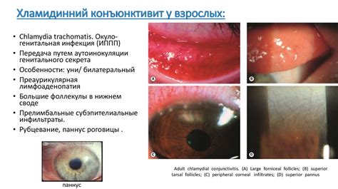 Основные методы диагностики поражения конъюнктивы глаза