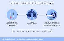 Основные преимущества Левинокса при лечении пневмонии