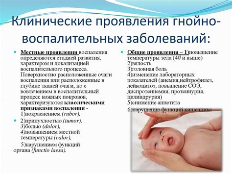 Основные симптомы паллиативного заболевания у ребенка