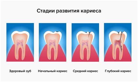 Основные симптомы флюса