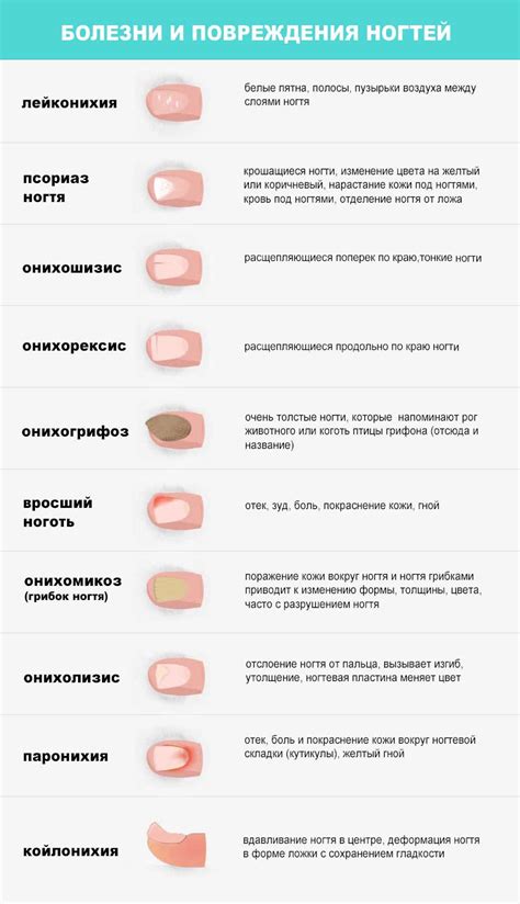 Основные трудности, связанные с состоянием ногтей и возможные способы их устранения