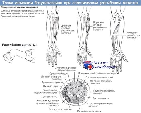 Основы перехвата запястья