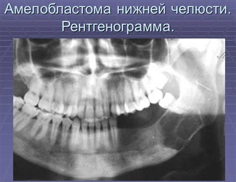 Ощущение покалывания на верхней и нижней периферии полости рта: главные факторы