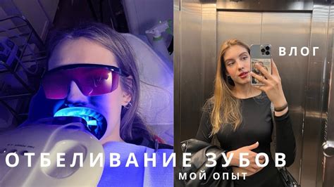 Ощущения во время процедуры