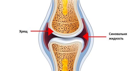 Патогенез и проявления воспаления в суставе