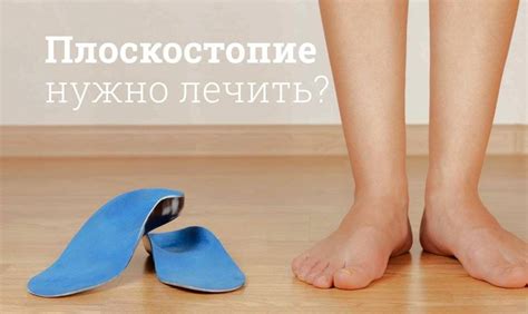 Плоскостопие и плоские подушечки 