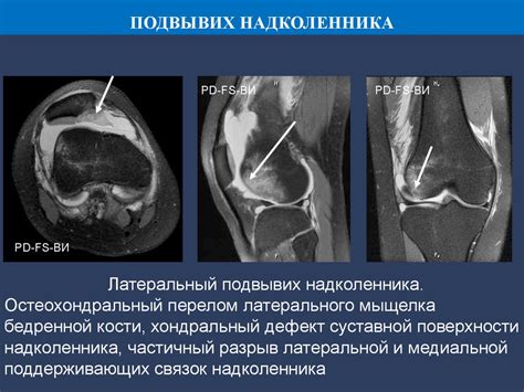 Повреждение кости