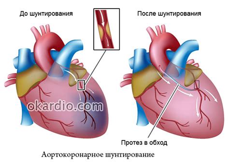 Повреждение сосудов и сердца