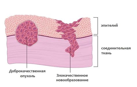 Повреждения и травмы как причина опухоли