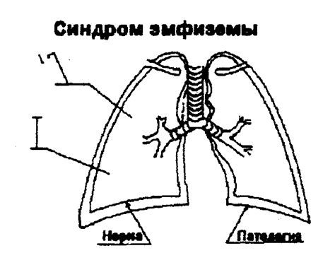 Повышение воздушности