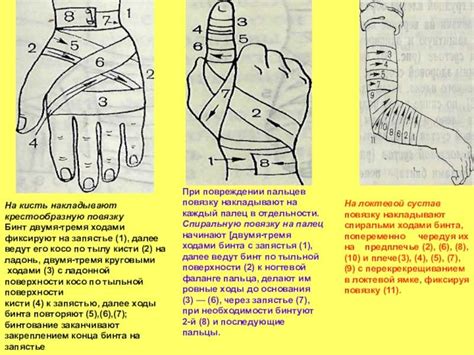 Повязка и фиксация порезанной ноги