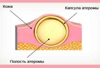 Подготовка кожи области уха и предотвращение возможных осложнений