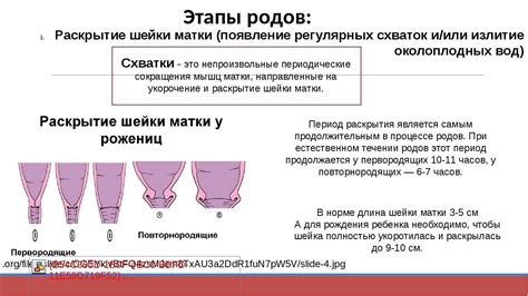 Показания для снятия пессария