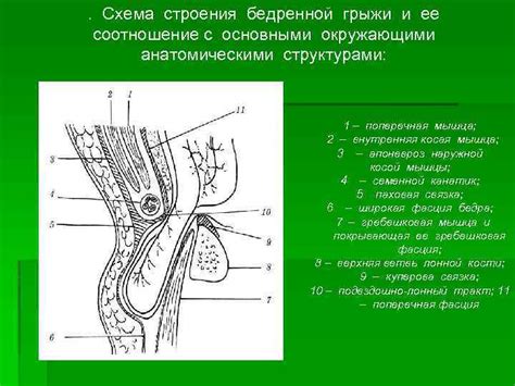 Понимание грыжи и ее типов