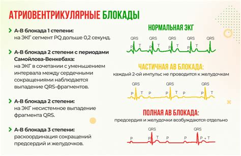 Понятие и симптомы блокады на ЭКГ