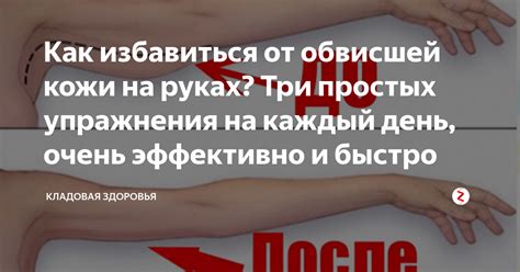 Популярные способы домашнего борьбы